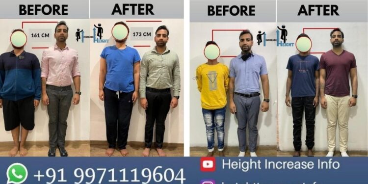 Navigating the Height: Limb Lengthening Surgery Costs in India (2025)